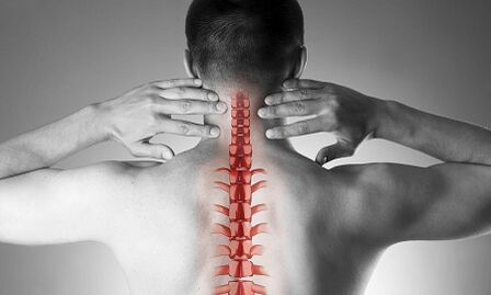 Cum se manifestă osteochondroza coloanei vertebrale cervicale